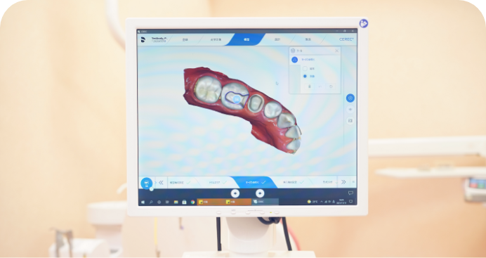 歯を早く修復したいあなたへ