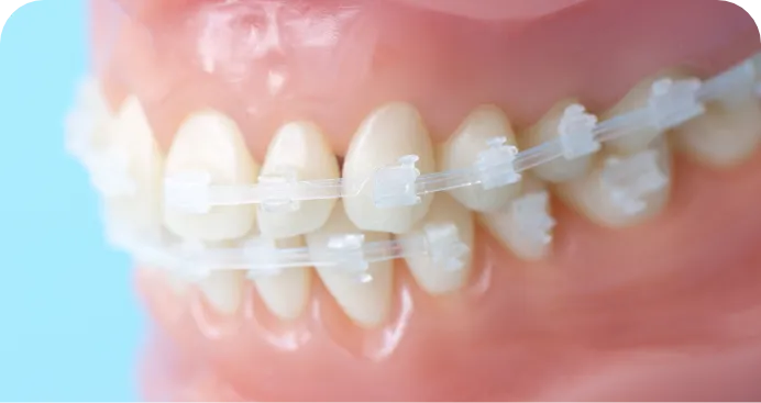 歯並びを気にしているあなたへ